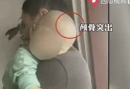 湖南郴州再现“大头娃娃” 事件始末原因真相曝光令人愤怒