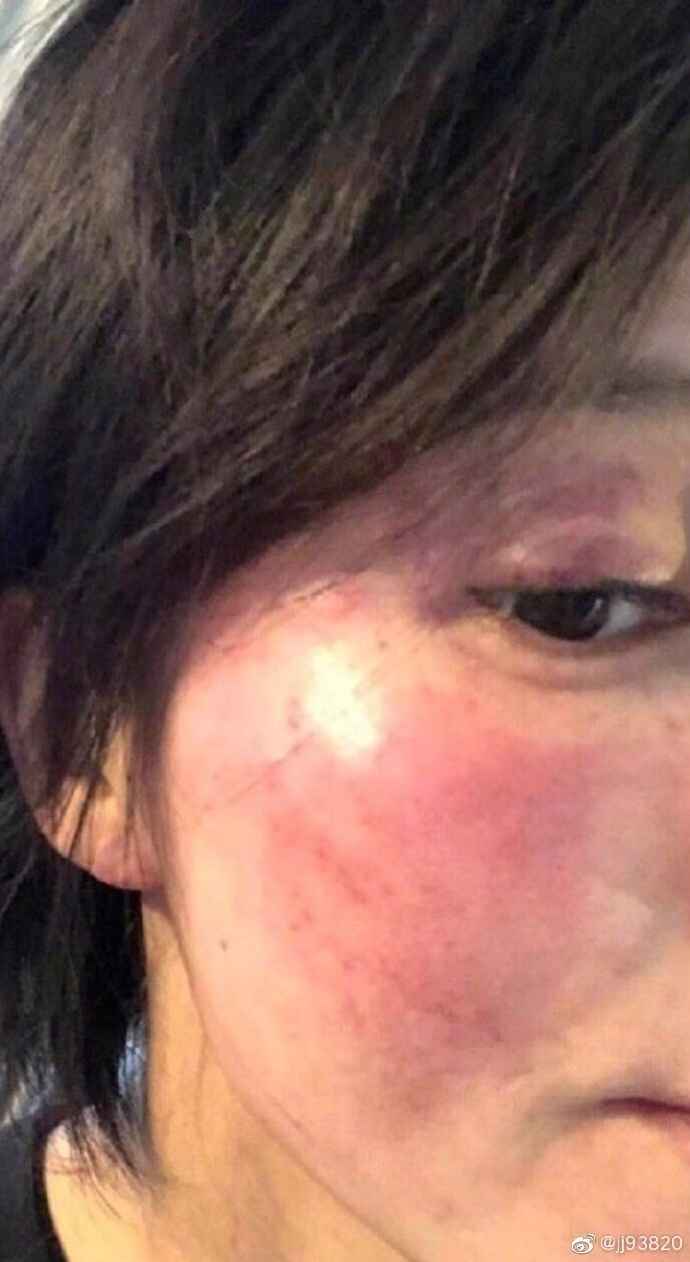 微博jj93820是谁 jj93820爆料黄景瑜家暴王雨馨内幕怎么回事