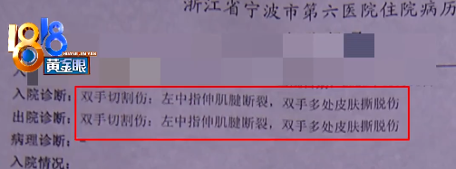 小张被浴室玻璃门割伤手上热搜怎么回事？看到小张后评论区全歪了