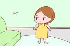 孕期双脚水肿像蹄膀怎么办?3个简单的方法帮你减轻水肿