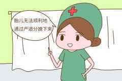 不想顺产的时候再挨一刀,孕期准妈妈可要乖乖做到这3点