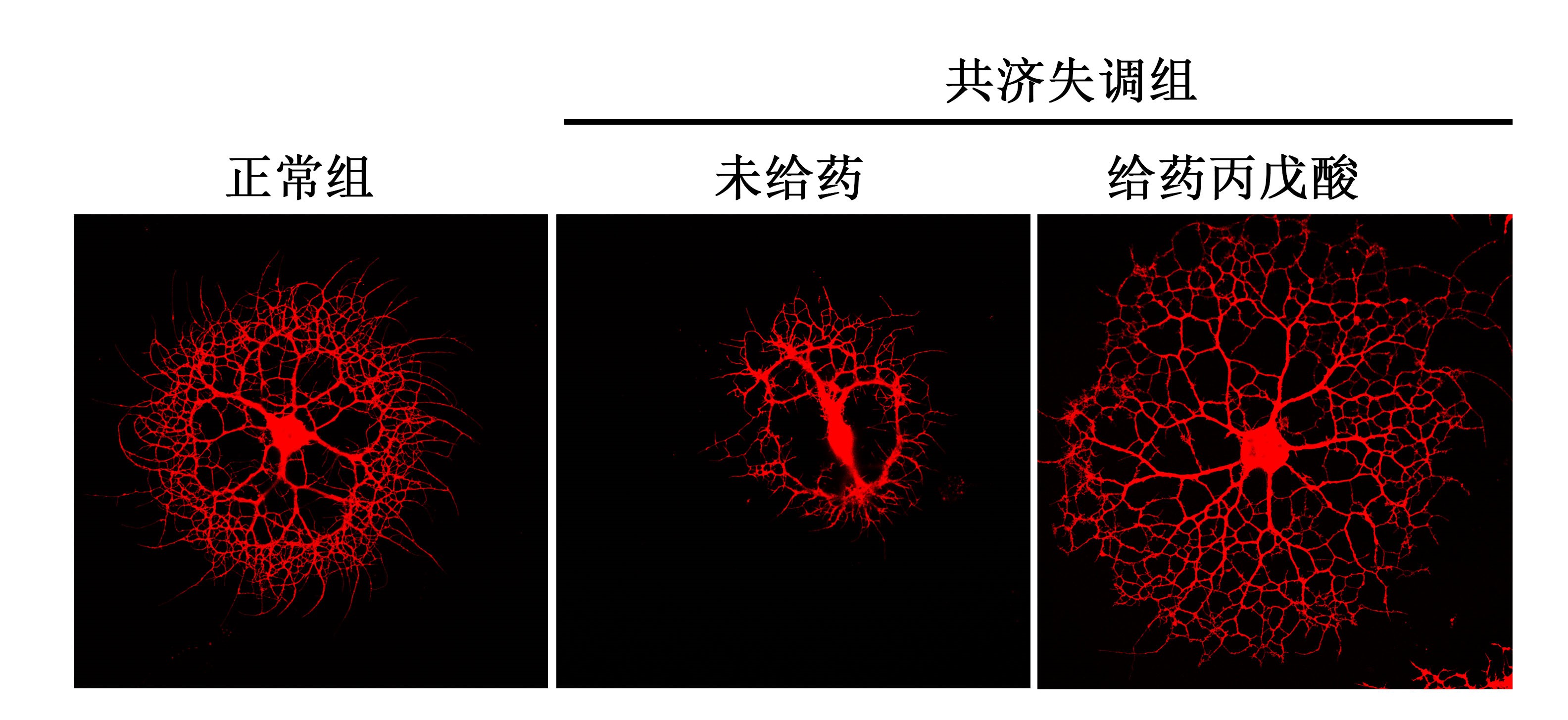 有望填补空白！抗癫痫“老药”立“新功”